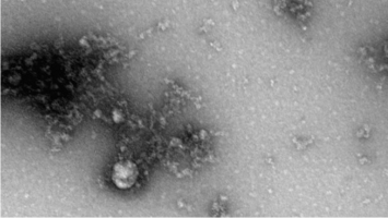 Снимена првата фотографија од британската варијанта на коронавирусот