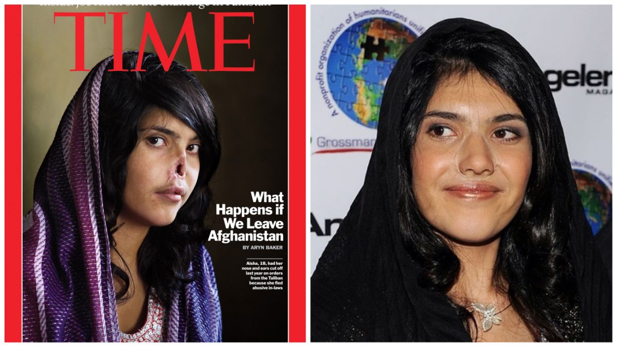 Биби Ајша, најпознатата жртва на талибанците на која ѝ ги отсекоа носот и ушите оти бегаше од мажот, по 12 операции повторно има убав лик, ама душата ѝ е тажна