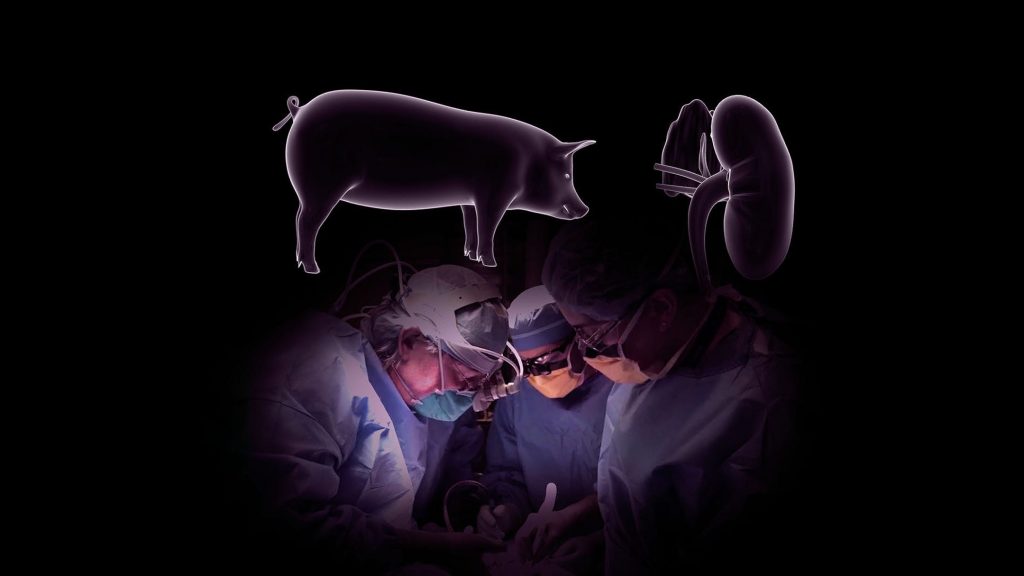 Во САД е извршена првата трансплантација на бубрег од свиња во човек