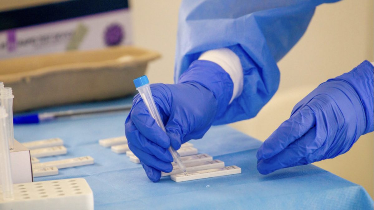 Во Русија развиен специјален тест за откривање на сојот „омикрон“