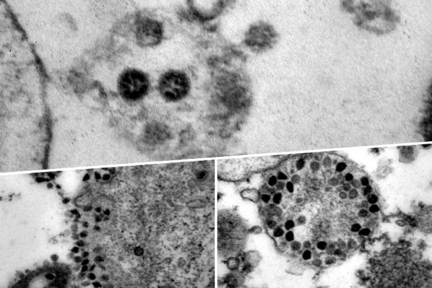 Руските научници ја направија првата фотографија од омикрон сојот на коронавирусот