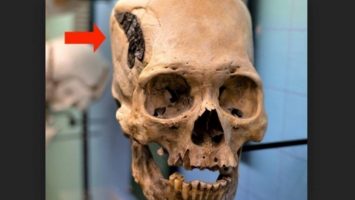 Мистериозен древен череп со чуден метален имплант ги збунува експертите