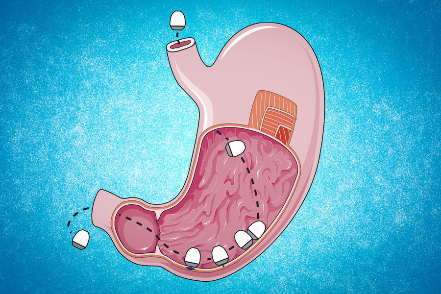 Научници од MIT создадоа капсула со MRNA вакцина наместо инјекција