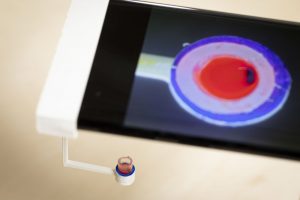 Научниците открија како да тестираат згрутчување на крвта користејќи само една капка и смартфон (ВИДЕО)