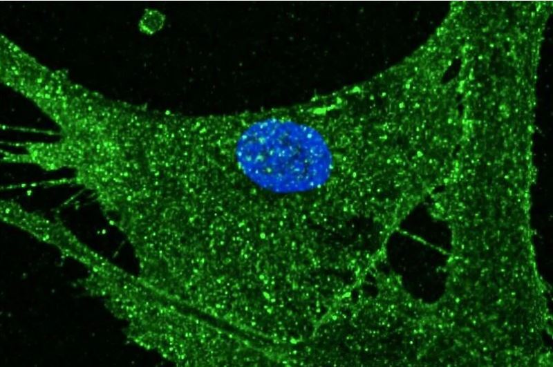 Научниците ги подмладија клетките на кожата на жените, изгледаат 30 години помлади