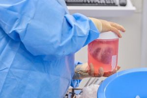 Две генетски модифицирани свински срца трансплантирани во САД