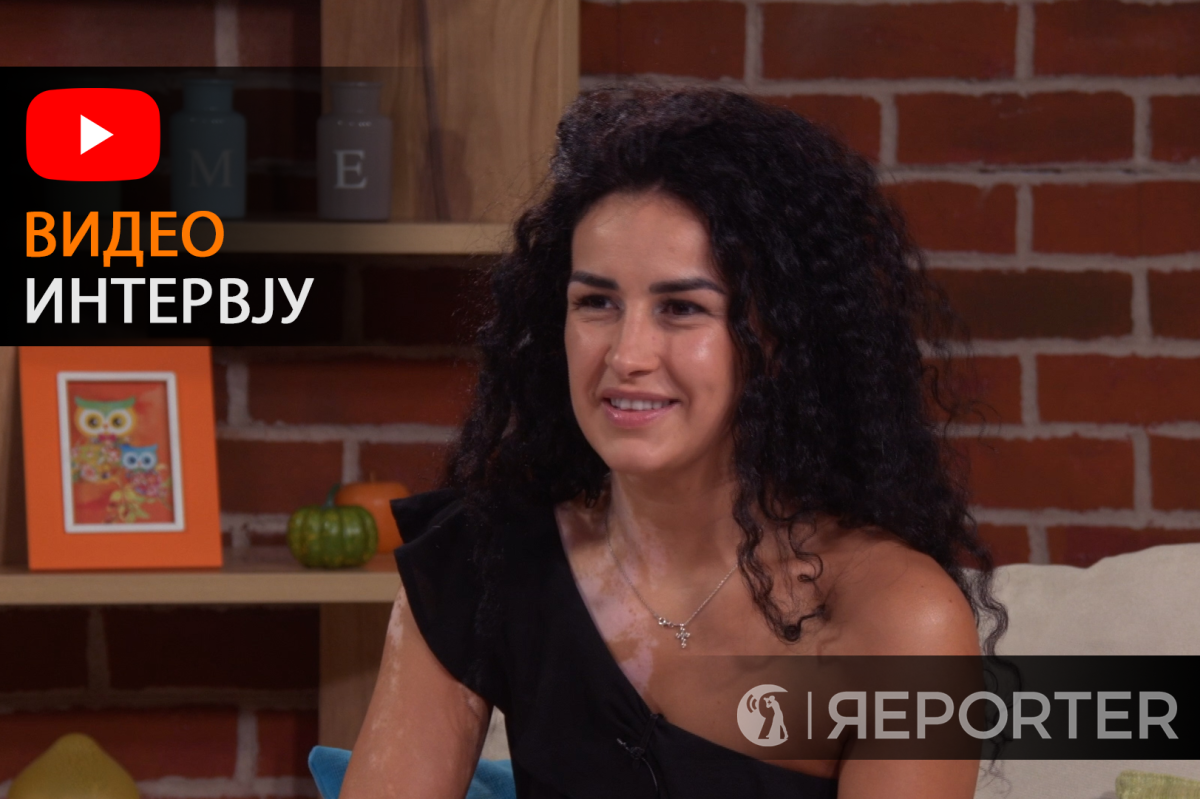 Да има лек засекогаш би ги тргнала белите дамки: Пулексенија Јовановска за болеста витлиго