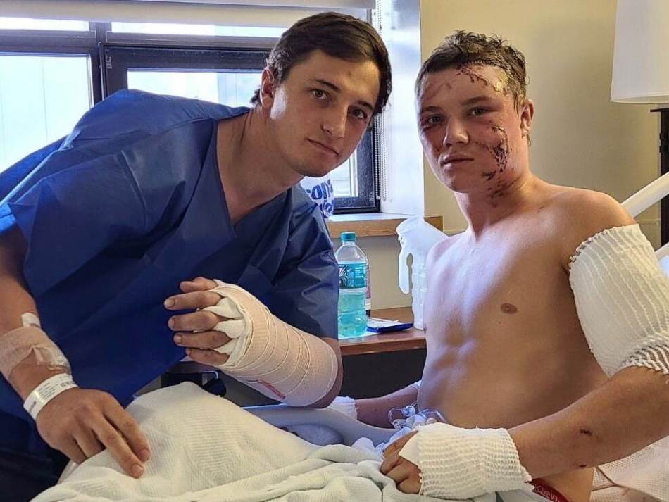 (Фото) Американски борач го спасил пријателот, кој бил нападнат од гризли