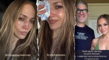 (Фото) Џенифер Лопез си ја удри главата за време на проба, морала на шиење: „Многу мраз и сум како нова“