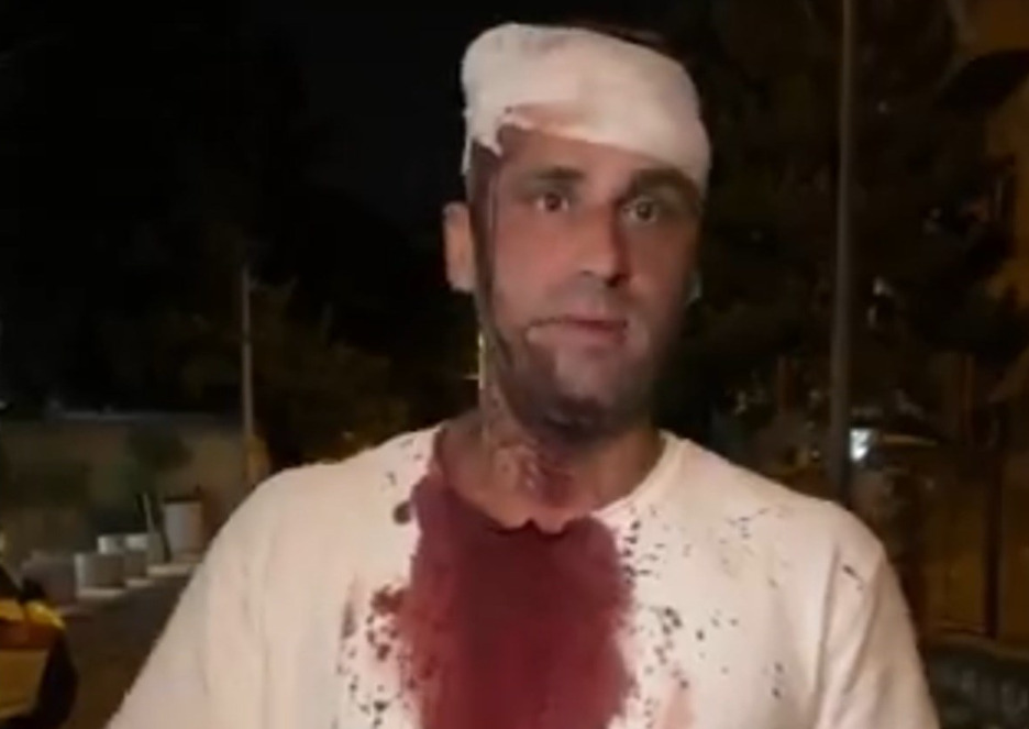 (Видео) Пратеник претепан во Белград: „Ме удираа со шипки по главата“