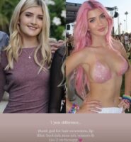 Ќерката на Чарли Шин објави фотографија „пред и потоа“: „Фала му на Бога за пластичната хирургија“