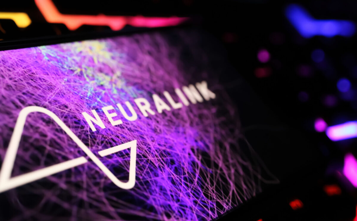 Човек со имплантиран чип Neuralink на Маск: „Чувството е неверојатно“